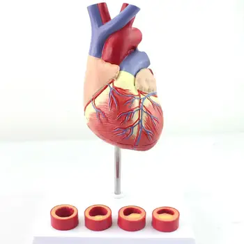 6 Частей человеческого сердца в натуральную величину с моделью тромбоза, медицинские обучающие модели